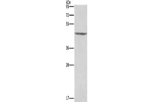 Gel: 8 % SDS-PAGE, Lysate: 40 μg, Lane: Human placenta tissue , Primary antibody: ABIN7191188(KCNJ9 Antibody) at dilution 1/350, Secondary antibody: Goat anti rabbit IgG at 1/8000 dilution, Exposure time: 1 second (KCNJ9 antibody)
