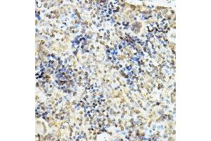 Immunohistochemistry of paraffin-embedded rat spleen using Glucocorticoid Receptor Rabbit pAb (ABIN3023090, ABIN3023091, ABIN3023092, ABIN1513281 and ABIN6219384) at dilution of 1:100 (40x lens). (Glucocorticoid Receptor antibody  (AA 1-280))