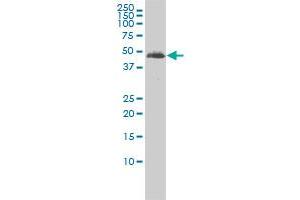 TUBA2 monoclonal antibody (M01), clone 3F10-2F2 Western Blot analysis of TUBA2 expression in Jurkat . (TUBA3C antibody  (AA 1-418))