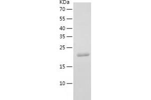 Western Blotting (WB) image for Fibroblast Growth Factor 19 (FGF19) (AA 23-216) protein (His tag) (ABIN7122928)