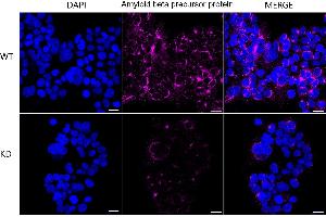 Immunocytochemical staining of HeLa cells using Amyloid beta precursor protein antibody (ABIN7797593), 1:1,000), Top panel: wild-type (WT), Bottom panal: Amyloid beta precursor protein shRNA knockdown (KD). (Recombinant APP antibody)