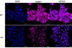 Immunocytochemical staining of HeLa cells using NAMPT antibody (ABIN7799595), 1:1,000), Top panel: wild-type (WT), Bottom panal: NAMPT shRNA knockdown (KD).