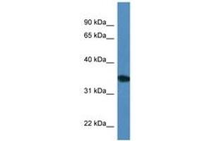 Image no. 1 for anti-Uridine Phosphorylase 2 (UPP2) (AA 200-249) antibody (ABIN6746297) (UPP2 antibody  (AA 200-249))