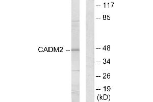 Western blot analysis of extracts from HepG2 cells, using CADM2 antibody.