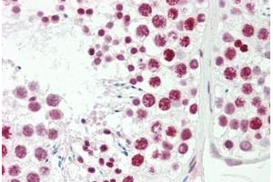 Human Testis: Formalin-Fixed, Paraffin-Embedded (FFPE) (FOXL1 antibody  (AA 94-119))