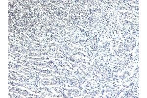 (ABIN185584) Negative Control showing staining of paraffin embedded Human Heart, with no primary antibody. (ADRB1 antibody  (Internal Region))