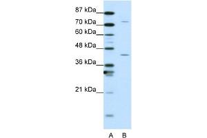 WB Suggested Anti-TCEA1 Antibody Titration:  1. (TCEA1 antibody  (N-Term))