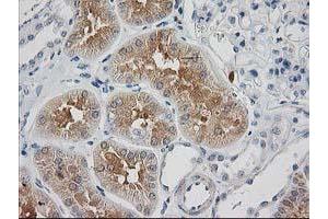 Image no. 2 for anti-Synaptosomal-Associated Protein, 25kDa (SNAP25) antibody (ABIN1501017) (SNAP25 antibody)
