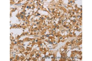 Immunohistochemistry of Human tonsil using RAD54L2 Polyclonal Antibody at dilution of 1:40