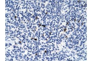 Serotonin receptor 3B antibody was used for immunohistochemistry at a concentration of 4-8 ug/ml to stain Spleen cells (arrows) in Human Spleen.