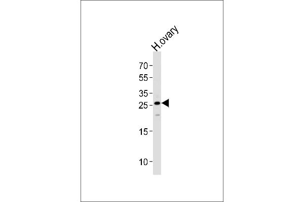 CCDC90B antibody  (AA 123-152)