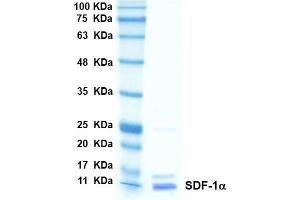 SDS-PAGE with Coomassie Blue staining