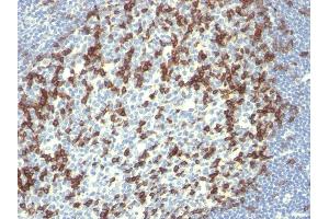 Formalin-fixed, paraffin-embedded human Tonsil stained with PD1 (CD279) Monoclonal Antibody (PDCD1/922). (PD-1 antibody)