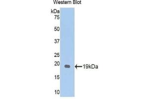 Detection of Recombinant GPC1, Mouse using Polyclonal Antibody to Glypican 1 (GPC1) (GPC1 antibody  (AA 155-292))