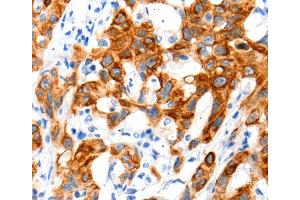 Immunohistochemistry (IHC) image for anti-Solute Carrier Family 2 (Facilitated Glucose Transporter), Member 11 (SLC2A11) antibody (ABIN2426005) (SLC2A11 antibody)