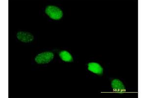 Immunofluorescence of purified MaxPab antibody to SOX13 on HeLa cell.