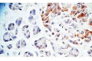 Human pancreas tissue was stained by Rabbit Anti-AdrenomeduIIiln-Gly (Human) Antibody (Adrenomedullin-Gly antibody)