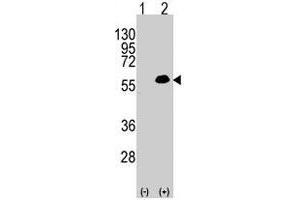 Western blot analysis of MEF2C (arrow) using rabbit MEF2C polyclonal antibody . (MEF2C antibody  (Thr300))