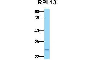 Western Blotting (WB) image for anti-Ribosomal Protein L13 (RPL13) (C-Term) antibody (ABIN2778677)