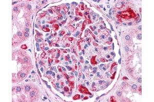 ApoE antibody was used for immunohistochemistry at a concentration of 4-8 ug/ml. (APOE antibody  (N-Term))