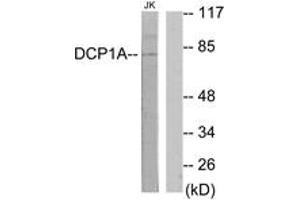 Western blot analysis of extracts from Jurkat cells, using DCP1A Antibody.