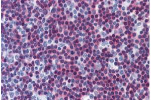 Human Tonsil: Formalin-Fixed, Paraffin-Embedded (FFPE) (CAMK4 antibody  (AA 1-474))