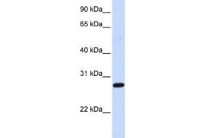 WB Suggested Anti-DCK Antibody Titration: 0. (DCK antibody  (Middle Region))