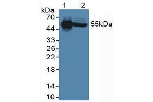 Figure. (IL-6 Receptor antibody  (AA 216-356))