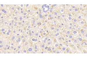 Detection of CEACAM1 in Mouse Liver Tissue using Polyclonal Antibody to Carcinoembryonic Antigen Related Cell Adhesion Molecule 1 (CEACAM1) (CEACAM1 antibody  (AA 35-143))