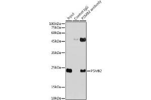 Immunoprecipitation analysis of 300 μg extracts of HeLa cells using 3 μg PSMB2 antibody (ABIN6129441, ABIN6146313, ABIN6146315 and ABIN6217703). (PSMB2 antibody  (AA 1-201))