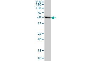 Western Blotting (WB) image for anti-Transcriptional Adaptor 2B (TADA2B) (AA 2-110) antibody (ABIN566675)