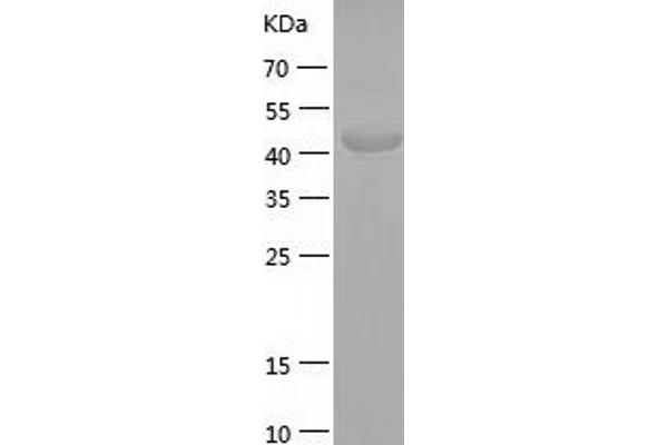 Neurexin 1 Protein (NRXN1) (AA 59-264) (His-IF2DI Tag)