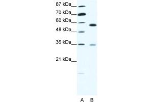 Western Blotting (WB) image for anti-GDP Dissociation Inhibitor 1 (GDI1) antibody (ABIN2463768) (GDI1 antibody)