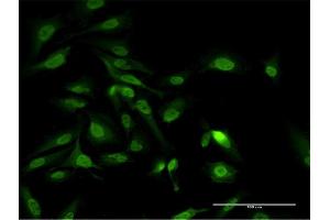 Immunofluorescence (IF) image for anti-Poly(A) Binding Protein Interacting Protein 1 (PAIP1) (AA 76-185) antibody (ABIN524025)