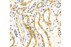 Immunohistochemistry of paraffin embedded human kidney using Aminome (ABIN7073036) at dilution of 1: 400 (400x lens) (Aminomethyltransferase antibody)