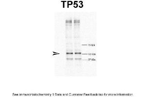 WB Suggested Anti-TP53 Antibody Titration: 1 ug/mlPositive Control: HeLa cells (p53 antibody  (N-Term))