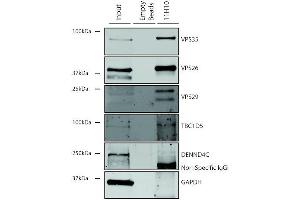 Immunoprecipitation analysis using Mouse Anti-VPS35 Monoclonal Antibody, Clone 11H10 (ABIN6933004).