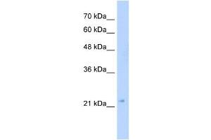 GMPR2 antibody used at 5 ug/ml to detect target protein. (GMPR2 antibody  (C-Term))