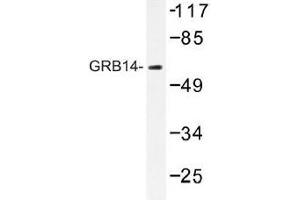 Image no. 1 for anti-Growth Factor Receptor-Bound Protein 14 (GRB14) antibody (ABIN317840)