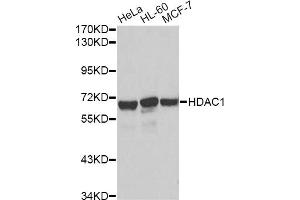 Western blot analysis of extracts of various cell lines, using HDAC1 antibody. (HDAC1 antibody)