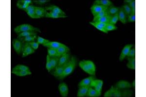 Immunofluorescence staining of HepG2 cells with ABIN7169643 at 1:133, counter-stained with DAPI. (SRP14 antibody  (AA 2-107))
