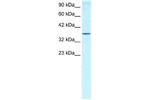 WB Suggested Anti-HOXA7 Antibody Titration:  0. (HOXA7 antibody  (N-Term))
