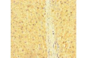 Immunohistochemistry of paraffin-embedded human adrenal gland tissue using ABIN7170352 at dilution of 1:100 (SNX14 antibody  (AA 601-893))