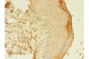 Immunohistochemistry of paraffin-embedded human skin tissue using ABIN7160224 at dilution of 1:100 (SMAD1 antibody  (AA 202-335))