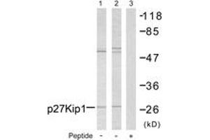 Western blot analysis of extracts from A2780 cells, using p27 Kip1 (Ab-10) Antibody. (CDKN1B antibody  (AA 1-50))
