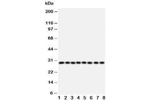 Western blot testing of CISH antibody and Lane 1:  rat liver (CISH antibody  (AA 241-258))