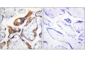 Immunohistochemistry analysis of paraffin-embedded human placenta, using PHLA2 Antibody. (PHLDA2 antibody  (AA 81-130))