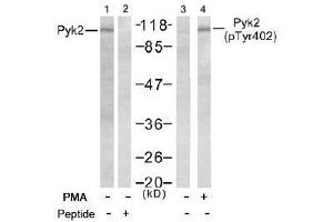 Image no. 2 for anti-PTK2B Protein tyrosine Kinase 2 beta (PTK2B) (pTyr402) antibody (ABIN196953) (PTK2B antibody  (pTyr402))