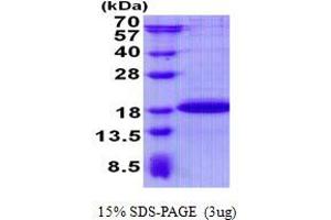 Succinate Dehydrogenase Complex Assembly Factor 2 (Sdhaf2) protein (His tag)