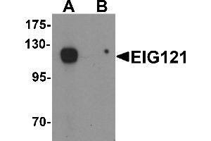 Western blot analysis of EIG121 in MCF7 cell lysate with EIG121 antibody at 1 µg/mL in (A) the absence and (B) the presence of blocking peptide. (ELAPOR1 antibody  (C-Term))